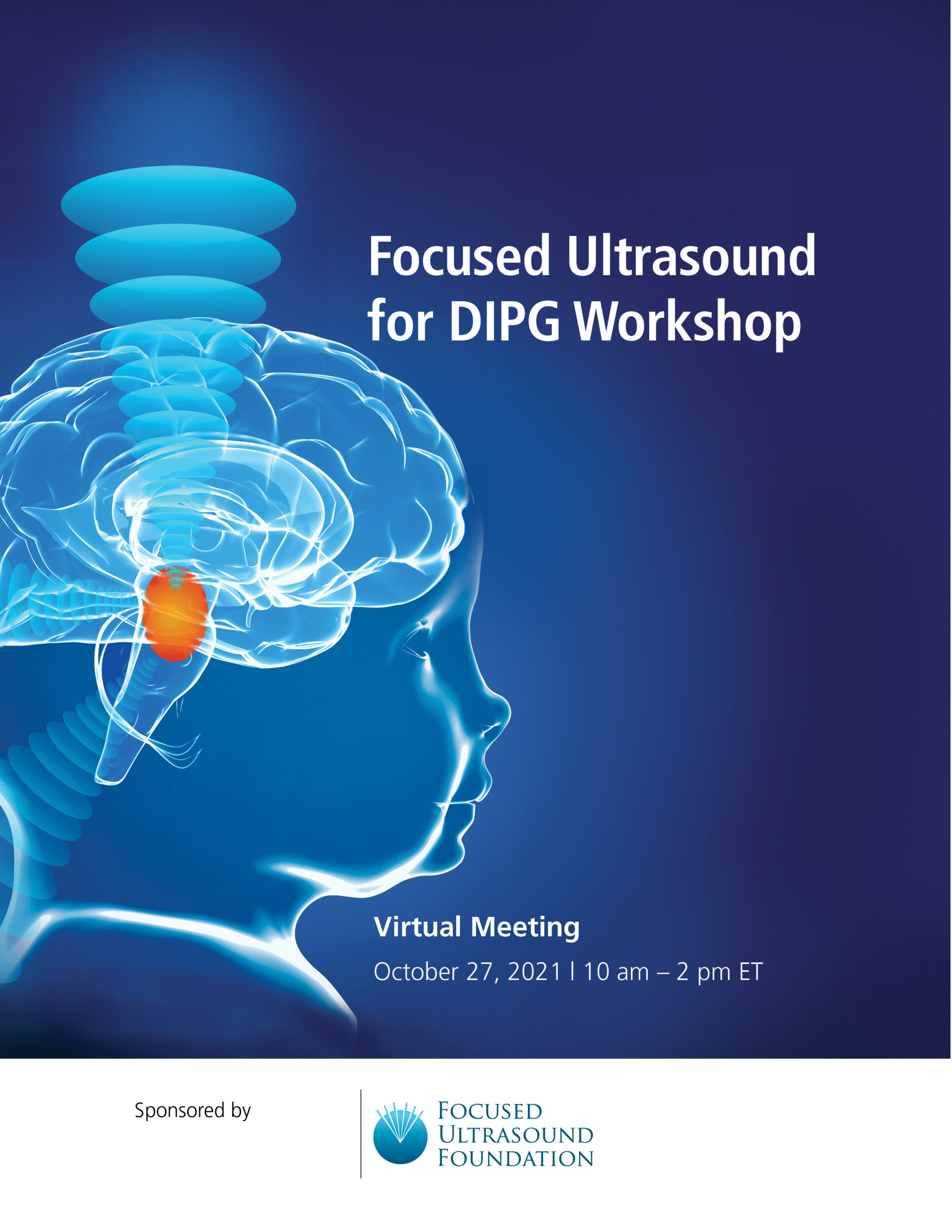 Foundation Holds Focused Ultrasound for DIPG Workshop - Focused ...