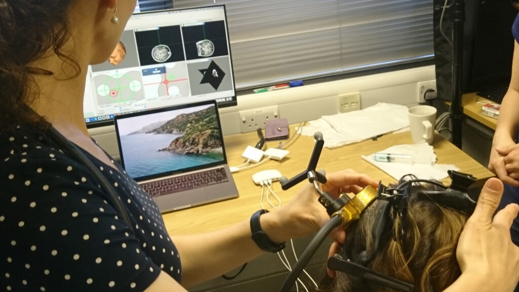 【ボクくん様用】SACRUM / Cognition Focused Ultrasound Neuromodulation Reveals a Role of the Brain's