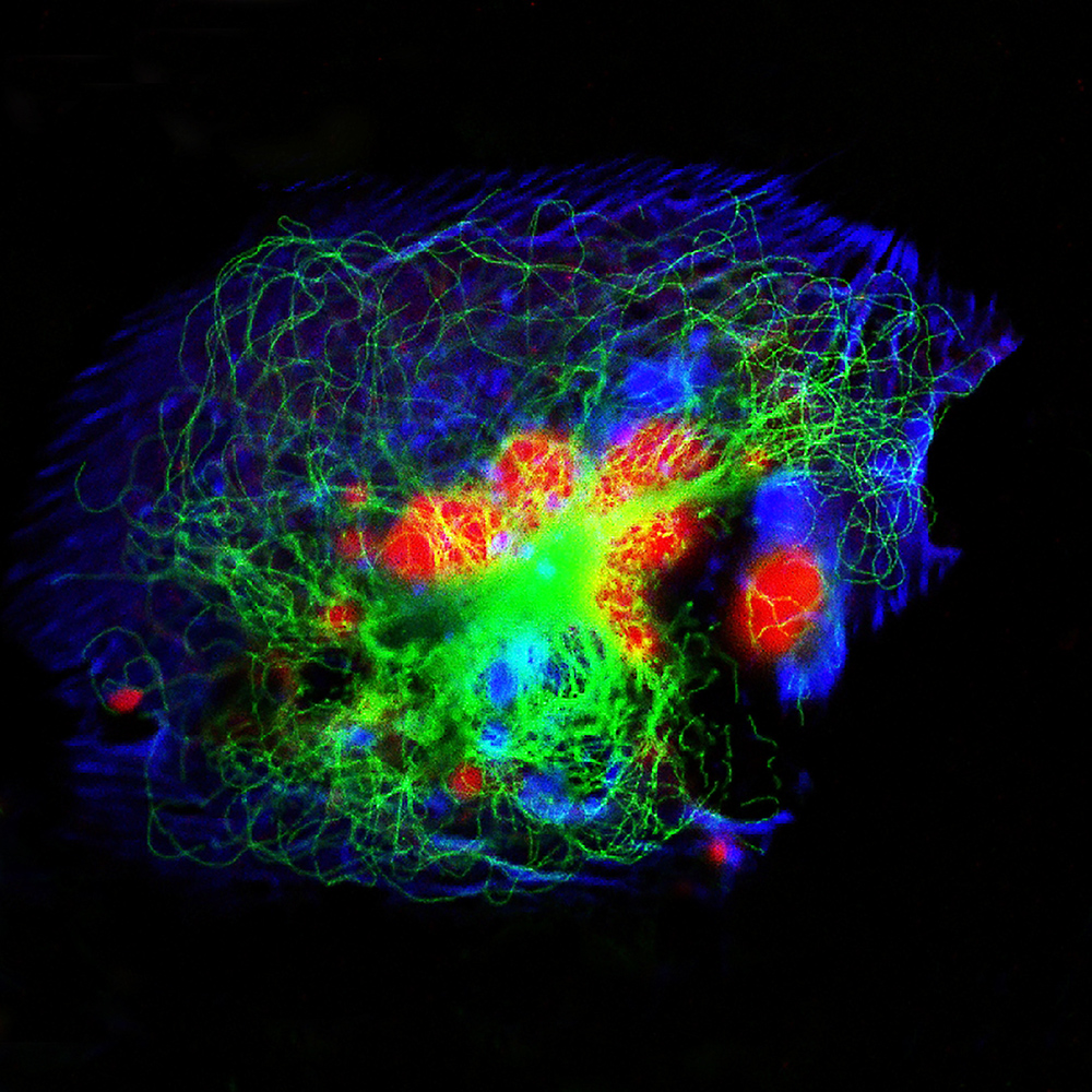 Real fluorescence microscopic view of human neuroblastoma cells